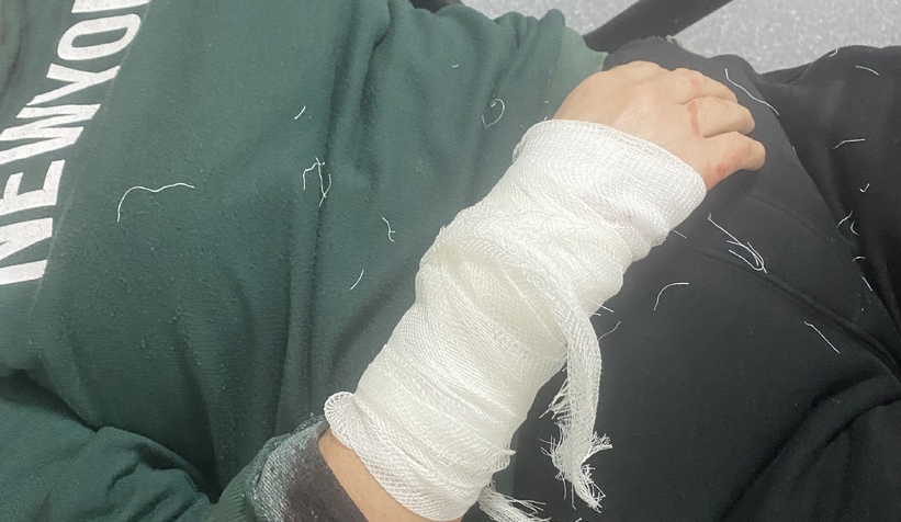 sokakta-kopegin-saldirisina-ugradin2k4owjxt2