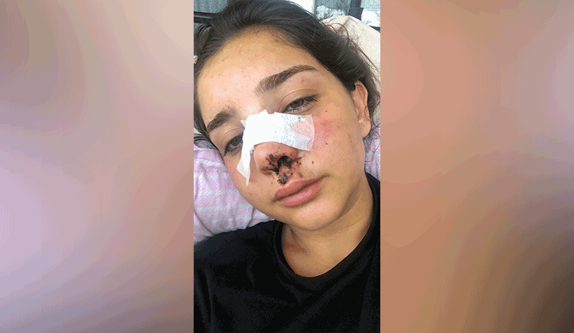 trafik-canavari-bisikletli-kiza-carpip-kactiu0t3tnzjv3