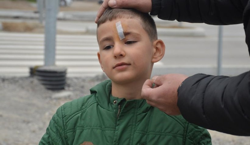 Trafik levhasına çarptı, alnına 7 dikiş atıldı