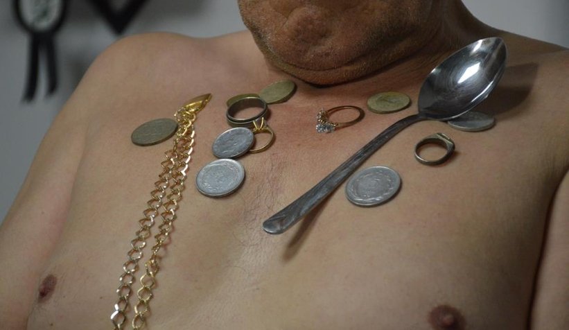 Vücuduna koyduğu materyalleri mıknatıs gibi çekiyor