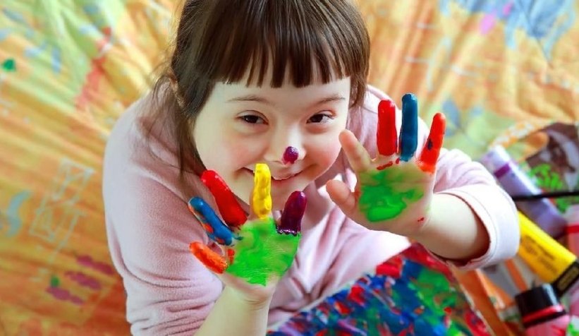 Yargıtay’dan, down sendromu vakasında doktora tazminat kararı