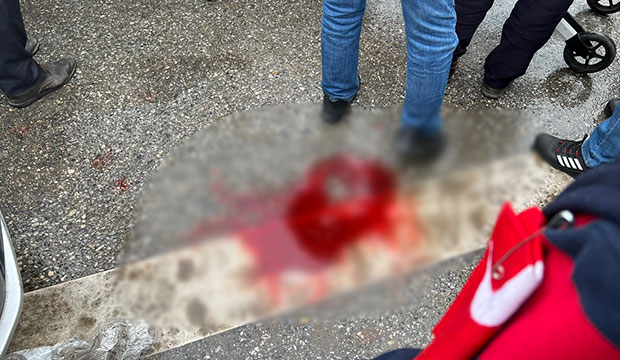 yaya-gecidinde-otomobil-carpti-kanlar-icinde-kaldidlfvdetweu