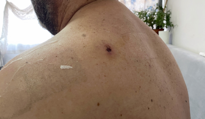 Yorgun mermi isabet etti yerinden fırladı: O anlar kamerada