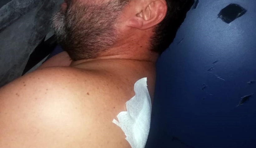 Yorgun mermi isabet etti yerinden fırladı: O anlar kamerada