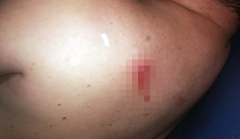 Yorgun mermi isabet etti yerinden fırladı: O anlar kamerada