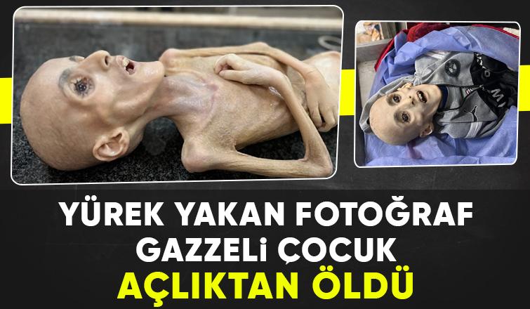 Gazze'de 10 yaşındaki çocuk açlıktan hayatını kaybetti
