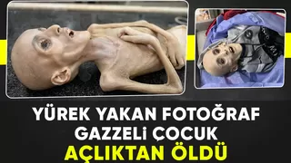 Gazze'de 10 yaşındaki çocuk açlıktan hayatını kaybetti