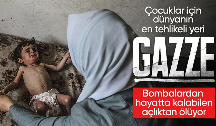 Gazze'de çocuklar yetersiz beslenme nedeniyle ölümle pençeleşiyor