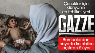 Gazze'de çocuklar yetersiz beslenme nedeniyle ölümle pençeleşiyor