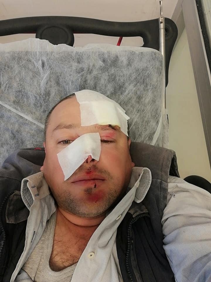 Geyve’de patpat kazası, ölümden döndü