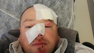 Geyve’de patpat kazası, ölümden döndü