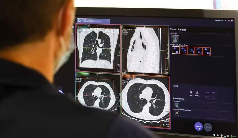 Gizemli akciğer hastalığı; 3 kişi hayatını kaybetti, vakalar artıyor