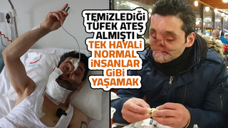 Gözlerini, çenesini ve burnunu kaybeden gencin hayali gerçek olacak