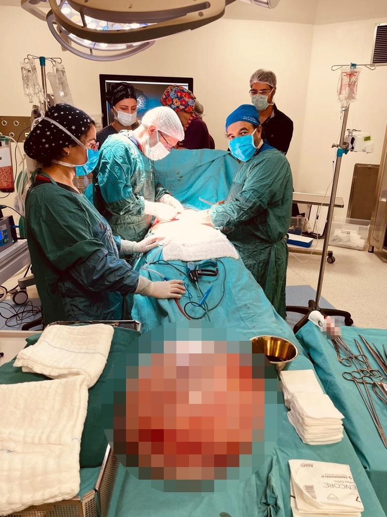 Hamile olduğunu sanıyordu, karnından 15 kilo kist çıktı