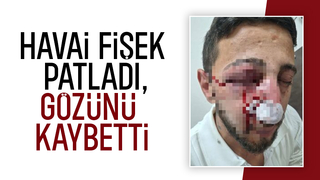 Havai fişek elinde patladı, gözünü kaybetti