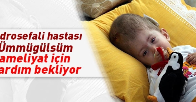 Hidrosefali hastası Ümmügülsüm ameliyat için yardım bekliyor