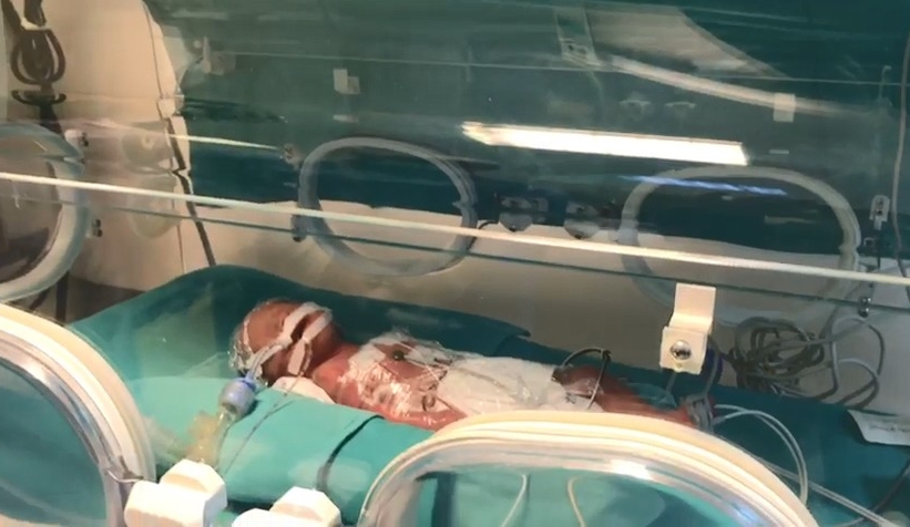 İki bebeğini kaybeden anne beşiz bebek dünyaya getirdi