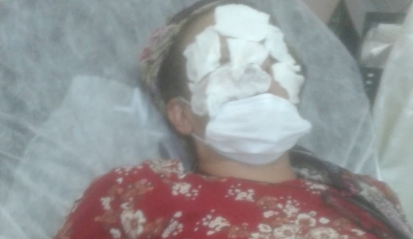 İlaçlama yaptı yüzü bu hale geldi