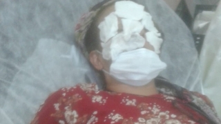 İlaçlama yaptı yüzü bu hale geldi