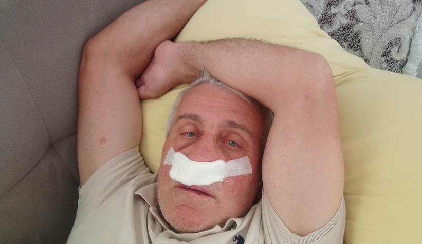 İlçe başkanının burnu kırıldı