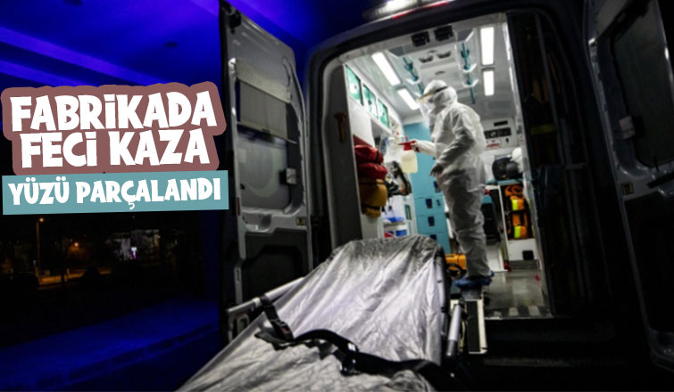 İşçinin yüzü parçalandı