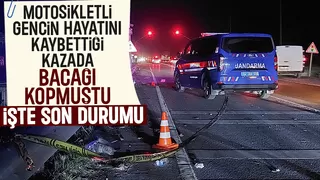 Kazada ayağı kopmuştu, son durumu açıklandı
