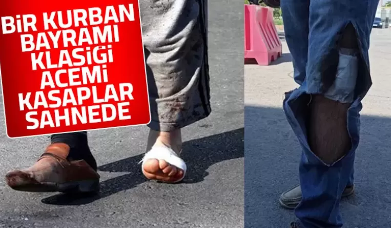Kendilerini kesen acemi kasaplar acile koştu