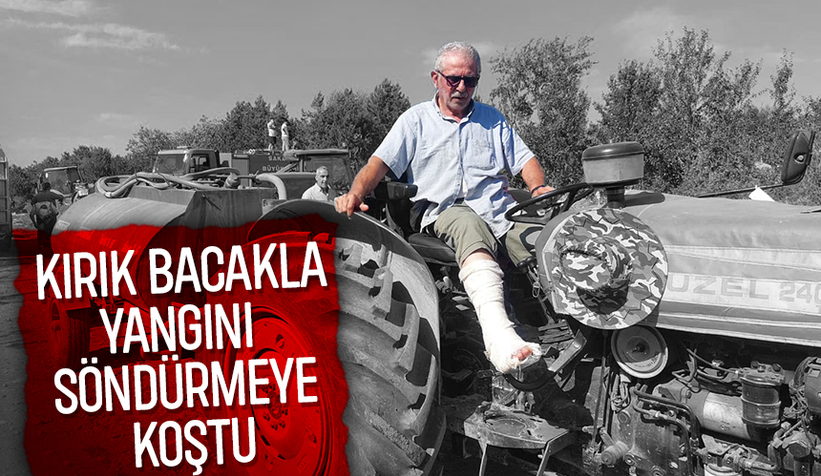 Kırık bacakla orman yangınına müdahaleye katıldı