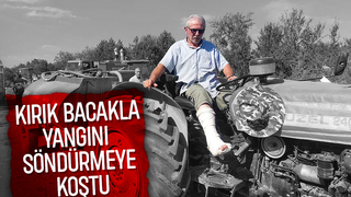 Kırık bacakla orman yangınına müdahaleye katıldı