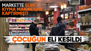 Kıyma makinesine kaptırdığı eli kesildi