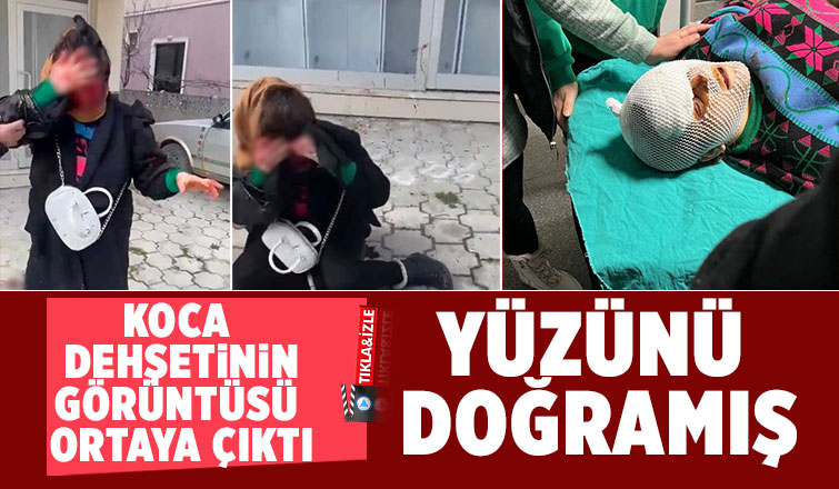 Kocası sokak ortasında bıçaklamıştı, görüntüsü ortaya çıktı