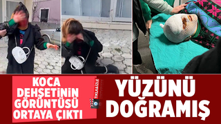 Kocası sokak ortasında bıçaklamıştı, görüntüsü ortaya çıktı