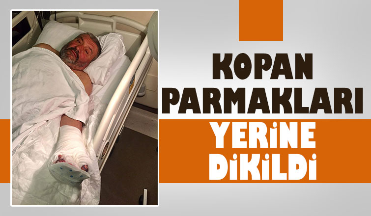 Kopan parmakları ameliyatla dikildi