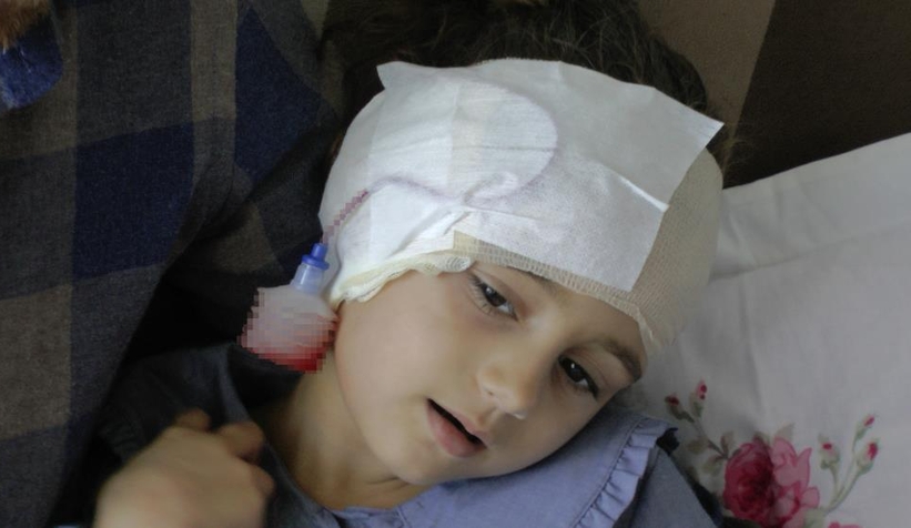 Köpek saldırısı bu hale getirdi; 300 dikiş atıldı