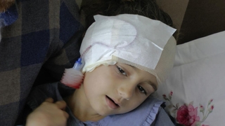 Köpek saldırısı bu hale getirdi; 300 dikiş atıldı