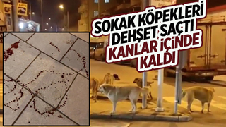Köpekler saldırdı kanlar içinde kaldı