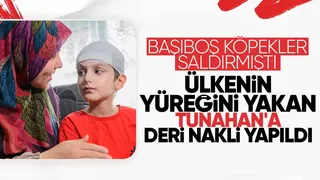 Köpekler saldırmıştı, Tunahan'a deri nakli yapıldı
