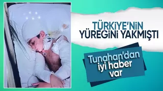 Köpeklerin saldırısına uğrayan Tunahan yoğun bakımdan çıktı