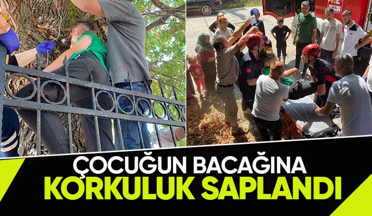 Korku dolu anlar Bacağına korkuluk saplandı