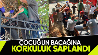 Korku dolu anlar Bacağına korkuluk saplandı