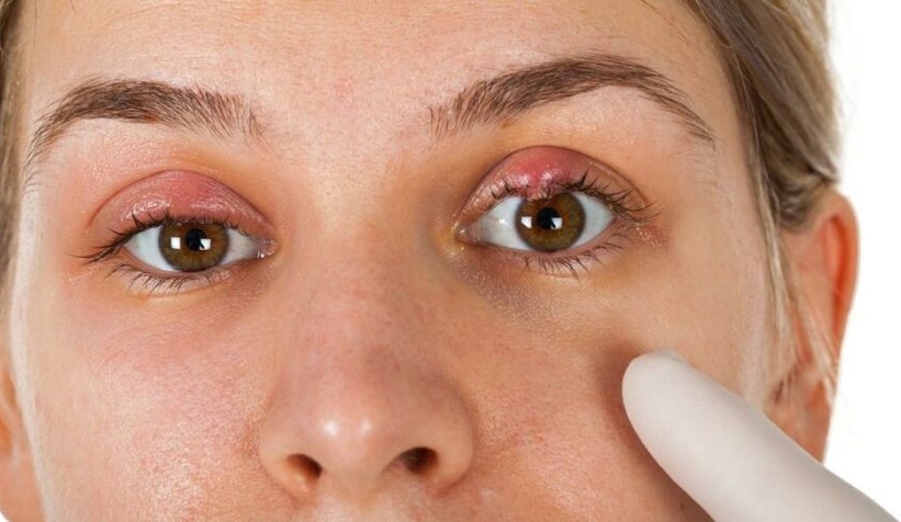 Korona gözlerde nodül oluşuyor