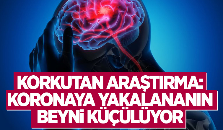 Koronaya yakalananın beyni küçülüyor
