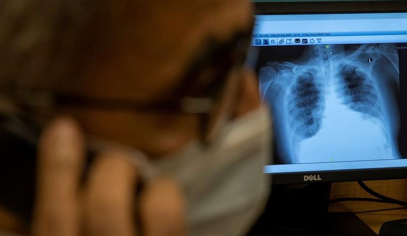 Koronayı yenenlerde korkunç bulgu