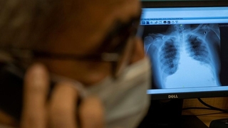 Koronayı yenenlerde korkunç bulgu