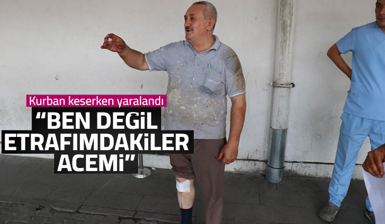 Kurban keserken yaralandı: Ben değil etrafımdakiler acemi