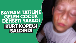 Kurt köpeğinin saldırdığı çocuk yaralandı