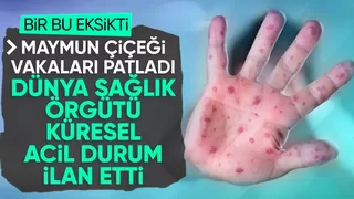 Maymun çiçeği virüsüne karşı dünya çapında acil durum ilan edildi