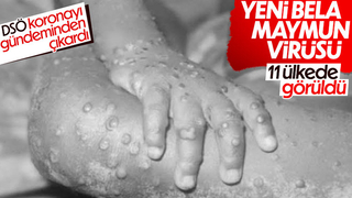 Maymun çiçeği virüsünün görüldüğü ülkeler