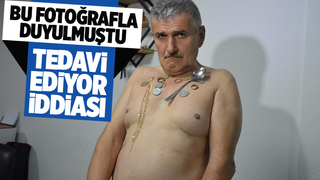 Mıknatıs Adam  hastaları tedavi ettiğini iddia etti