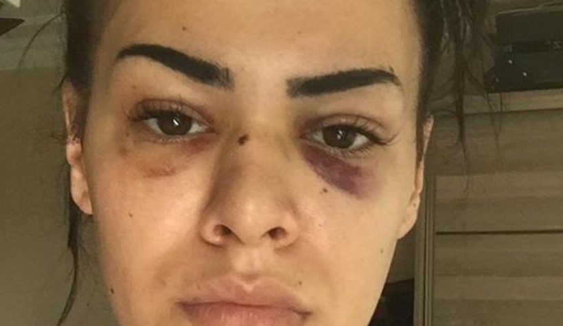 Nagehan dehşeti yaşadı